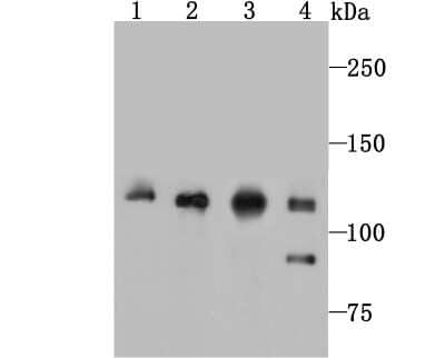 Western Blot: Vinculin Antibody (JM42-43) [NBP2-75708] - Analysis of Vinculin on different lysates using anti-Vinculin antibody at 1/1,000 dilution.Positive control:Lane 1: HepG2  Lane 2: Human fetal skeletal muscleLane 3: Rat spleen      Lane 4: Mouse kidney