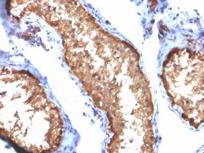 Immunohistochemistry-Paraffin: Vinculin Antibody (VCL/2572) - Azide and BSA Free [NBP2-79940] - Formalin-fixed, paraffin-embedded human Testis stained with VCL Mouse Monoclonal Antibody (VCL/2572).