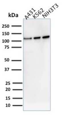 Western Blot: Vinculin Antibody (VCL/2575) [NBP2-79808] - Western Blot Analysis of human A431, K562, NIH3T3 cell lysate using Vinculin Antibody (VCL/2575).