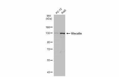 Western Blot: Vinculin Antibody [NBP2-20859] - Various whole cell extracts (30 ug) were separated by 7.5% SDS-PAGE, and the membrane was blotted with Vinculin antibody diluted at 1:1000. HRP-conjugated anti-rabbit IgG antibody was used to detect the primary antibody.