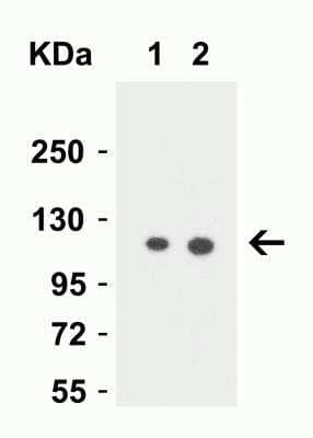 Western Blot: Vinculin Antibody [NBP2-41237] - Western Blot Validation in Human PC-3 Cell Lysate. Loading: 15 ug of lysates per lane. Antibodies: Vinculin NBP2-41237 (Lane 1: 0.5 ug/mL and Lane 2: 1 ug/mL), 1h incubation at RT in 5% NFDM/TBST. Secondary: Goat anti-rabbit IgG HRP conjugate at 1:10000 dilution.