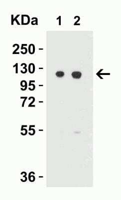 Western Blot: Vinculin Antibody [NBP2-41237] - Western Blot Validation in Mouse 3T3/balb Cell Lysate. Loading: 15 ug of lysates per lane. Antibodies: Vinculin NBP2-41237 (Lane 1: 0.5 ug/mL and Lane 2: 1 ug/mL), 1h incubation at RT in 5% NFDM/TBST. Secondary: Goat anti-rabbit IgG HRP conjugate at 1:10000 dilution.