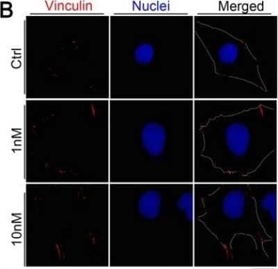 Immunocytochemistry/Immunofluorescence: Vinculin Antibody (hVIN-1) [NB600-1293] - Immunofluorescence images of LM8 cells treated with 0 nM, 1 nM, or 10 nM eribulin and stained for vinculin (red) and nucleus (blue) (left). Dotted line shows the cell shape. Scale bar: 10 um. Quantitative analysis of the area of vinculin staining (right). Values are mean +/- SEM (less than or equal to 30 cells per group). **P < 0.01. Image collected and cropped by CiteAb from the following publication (//pubmed.ncbi.nlm.nih.gov/30719211/) licensed under a CC-BY license.