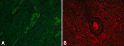 Immunohistochemistry: Vinculin Antibody (hVIN-1) [NB600-1293] - Enhanced Validation-By Independent Antibodies:Immunohistochemistry. Formalin-fixed, paraffin-embedded Rat Heart sections stained with 15 ug/mL Anti-Vinculin antibody produced in Rabbit (Cat. No. V4139) (A). The antibody was developed using Anti-Rabbit IgG (whole molecule)-FITC antibody produced in Goat (Cat. No. F9887), and 15 ug/mL Monoclonal Anti-Vinculin antibody produced in Mouse, Clone: hVIN1 (Cat. No. V9131) (B). The antibody was developed using Rabbit Anti-Mouse IgG-Cy3 conjugate antibody.Results:Two Anti-Vinculin antibodies, V4139 (A) and V9131 (B), target different regions of Vinculin show similar staining profiles between the two antibodies, demonstrating Independent Antibody Verification.