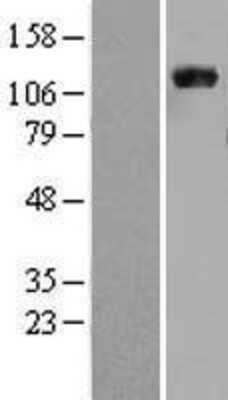 Western Blot: Vinculin Overexpression Lysate (Adult Normal) [NBL1-17706] Left-Empty vector transfected control cell lysate (HEK293 cell lysate); Right -Over-expression Lysate for Vinculin.