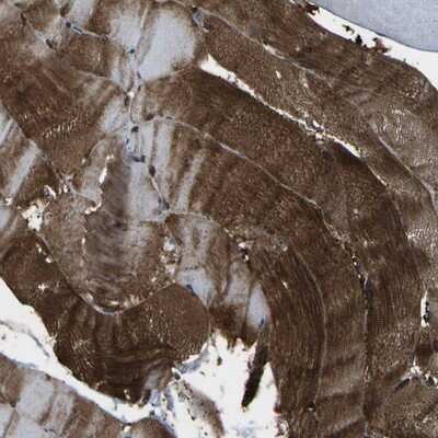 Immunohistochemistry-Paraffin: Vinexin Antibody [NBP1-87084] - Staining of human skeletal muscle shows strong cytoplasmic positivity.