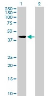 Western Blot: Vinexin Antibody [H00010174-B01P] - Analysis of SORBS3 expression in transfected 293T cell line by SORBS3 polyclonal antibody.  Lane 1: SORBS3 transfected lysate(36.19 KDa). Lane 2: Non-transfected lysate.