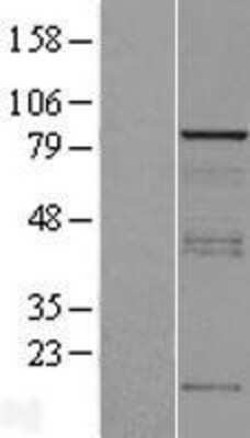 Western Blot: Vinexin Overexpression Lysate (Adult Normal) [NBP2-10442] Left-Empty vector transfected control cell lysate (HEK293 cell lysate); Right -Over-expression Lysate for Vinexin.