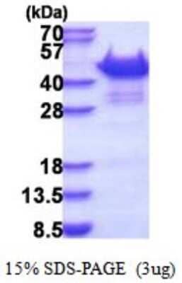SDS-Page: Vinexin Recombinant Protein [NBP2-51520] - 15% SDS Page (3 ug)