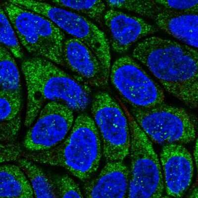 Immunocytochemistry/Immunofluorescence: Viperin Antibody [NBP2-58186] - Staining of human cell line RT4 shows localization to nucleoli fibrillar center & endoplasmic reticulum. Antibody staining is shown in green.