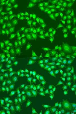 Immunocytochemistry/Immunofluorescence: Viperin Antibody [NBP2-93524] - Analysis of U2OS cells using Viperin at dilution of 1:100. Blue: DAPI for nuclear staining.