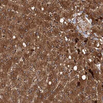 Immunohistochemistry-Paraffin: Viperin Antibody [NBP1-84467] - Staining of human liver shows strong cytoplasmic positivity in hepatocytes.