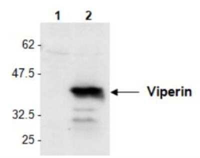 Western Blot: Viperin Antibody [NBP2-89062] - Detection of mouse Viperin in L929 cells by Western Blot using PAb to Viperin (AT131) Method: Cell extracts from L929 cell either unstimulated (lane 1) or stimulated for 24h with poly(dA.dT) poly(dT.dA) at 3ug/ml (lane 2) were resolved by SDS-PAGE under reducing conditions, transferred to nitrocellulose and incubated with the PAb to Viperin (AT131) at a 1:1000 dilution for 1 hour. Proteins were visualized using a peroxidase-conjugated polyclonal antibody to rabbit IgG and a chemiluminescence detection system.