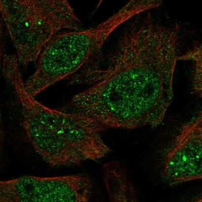 Immunocytochemistry/ Immunofluorescence Virilizer Antibody - BSA Free