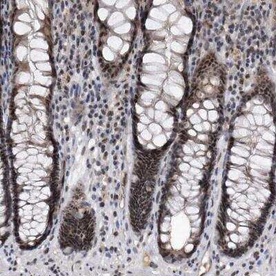 Immunohistochemistry-Paraffin: Virilizer Antibody [NBP1-85118] - Staining of human rectum shows moderate nuclear positivity in glandular cells.