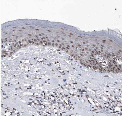 Immunohistochemistry-Paraffin: Virilizer Antibody [NBP1-85118] - Staining of human skin shows moderate nuclear positivity in squamous epithelial cells.