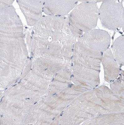 Immunohistochemistry-Paraffin: Virilizer Antibody [NBP1-85118] - Staining of human skeletal muscle shows very weak cytoplasmic positivity in myocytes.
