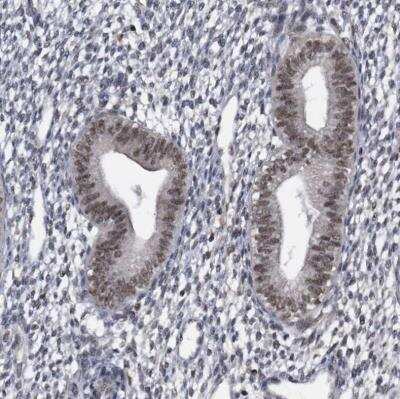 Immunohistochemistry-Paraffin: Virilizer Antibody [NBP1-85118] - Staining of human endometrium shows moderate to strong nuclear positivity in glandular cells.