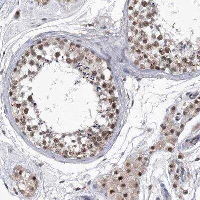 Immunohistochemistry-Paraffin: Virilizer Antibody [NBP1-85118] - Staining of human testis shows moderate to strong nuclear positivity in cells in seminiferous ducts.