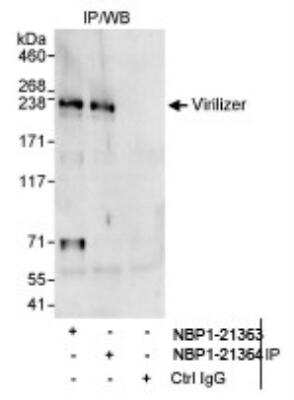 Immunoprecipitation: Virilizer Antibody [NBP1-21363] - Whole cell lysate (1 mg for IP, 20% of IP loaded) from HeLa cells. Affinity purified rabbit anti-Virilizer antibody  used for IP at 10 mcg/mg lysate.
