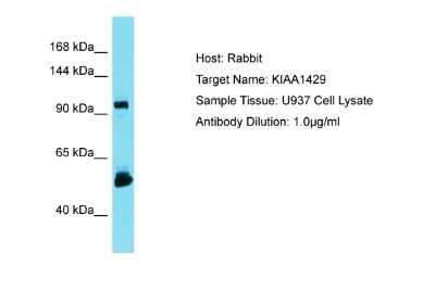 Western Blot: Virilizer Antibody [NBP2-88576] - Host: Rabbit. Target Name: KIAA1429. Sample Type: U937 Whole Cell lysates. Antibody Dilution: 1.0ug/ml