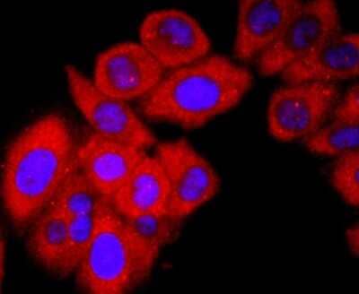 Immunocytochemistry/Immunofluorescence: Vitamin D BP Antibody (JM10-36) [NBP2-66786] - Staining DBP in HepG2 cells (red). The nuclear counter stain is DAPI (blue). Cells were fixed in paraformaldehyde, permeabilised with 0.25% Triton X100/PBS.