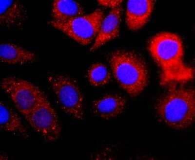 Immunocytochemistry/Immunofluorescence: Vitamin D BP Antibody (JM10-36) [NBP2-66786] - Staining DBP in SKOV-3 cells (red). The nuclear counter stain is DAPI (blue). Cells were fixed in paraformaldehyde, permeabilised with 0.25% Triton X100/PBS.