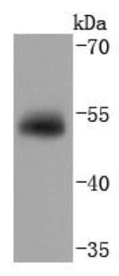 Western Blot: Vitamin D BP Antibody (JM10-36) [NBP2-66786] - Analysis of DBP on human lung lysates using anti- DBP antibody at 1/1,000 dilution.