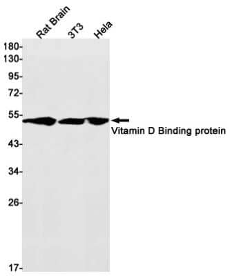 Western Blot: Vitamin D BP Antibody (S03-5G8) [NBP3-14983] - Western blot detection of Vitamin D BP in Rat Brain, 3T3, Hela cell lysates using Vitamin D BP Rabbit mAb (1:1000 diluted). Predicted band size: 53kDa. Observed band size: 53kDa.