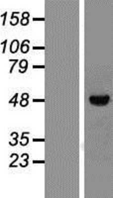 Western Blot: Vitamin D Receptor Overexpression Lysate (Adult Normal) [NBP2-11022] Left-Empty vector transfected control cell lysate (HEK293 cell lysate); Right -Over-expression Lysate for Vitamin D Receptor.