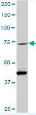 Western Blot: Vitronectin Antibody [H00007448-D01P] - Expression in mouse lung.
