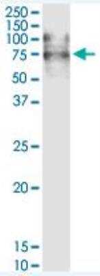 Western Blot: Vitronectin Antibody [H00007448-D01P] - Expression in human spleen.