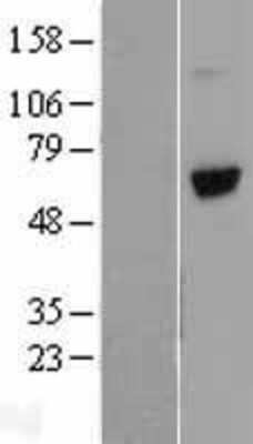 Western Blot Vitronectin Overexpression Lysate