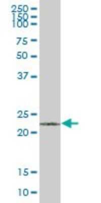 Western Blot: Von Hippel Lindau Antibody [H00007428-B01P] - Analysis of VHL expression in human placenta.