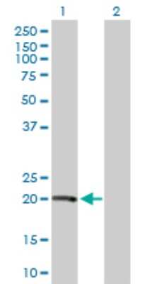 Western Blot: Von Hippel Lindau Antibody [H00007428-B01P] - Analysis of VHL expression in transfected 293T cell line by VHL polyclonal antibody.  Lane 1: VHL transfected lysate(18.92 KDa). Lane 2: Non-transfected lysate.