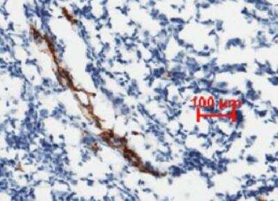 Immunohistochemistry-Paraffin: Von Willebrand Factor Antibody (111) [NBP2-89724] - Staining of human tonsil showing blood vessel staining (1:1000).