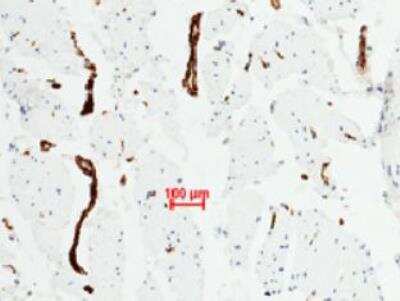 Immunohistochemistry-Paraffin: Von Willebrand Factor Antibody (111) [NBP2-89724] - Staining of  human muscle showing blood vessel staining (1:1000).