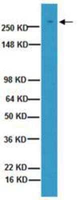 Western Blot: Von Willebrand Factor Antibody (21-43) [NB100-65194] - Human Placenta lysate was resolved by electrophoresis, transferred to PVDF membrane and probed with anti-von Willebrand Factor (1:1000 dilution). Proteins were visualized using a goat anti-mouse secondary antibody conjugated to HRP and a chemiluminescence detection system.  Arrow indicates protein von Willebrand Factor (~310 kDa).