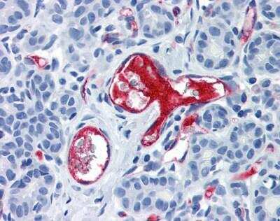 Immunohistochemistry-Paraffin: Von Willebrand Factor Antibody (2Q2134) [NBP1-39497] - Staining of human breast, vessels. Immunohistochemistry of formalin-fixed, paraffin-embedded tissue after heat-induced antigen retrieval. Antibody concentration 10 ug/ml.