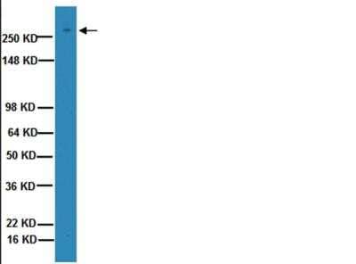 Western Blot: Von Willebrand Factor Antibody (2Q2134) [NBP1-39497] - Human placenta lysate was resolved by electrphoresis, transferred to PVDF membrane and probed with NBP1-39497 (1:1000). Proteins were visualized using and IgG (HRP) goat anti-mouse and a chemiluminescence detection system. Arrow indicates protein von Willebrand Factor (310KD).