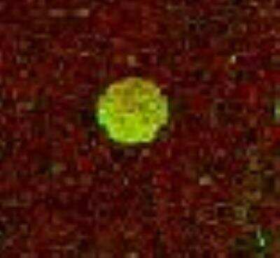 Von Willebrand Factor Antibody [32700002] - Antibody was printed on custom arrays and incubated with fluorescently labeled human EDTA plasma. Microarray image submitted by a verified customer review.