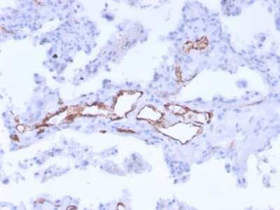 Immunohistochemistry-Paraffin: Von Willebrand Factor Antibody (3E2D10 + VWF635) - Azide and BSA Free [NBP2-34536] - Formalin-fixed, paraffin-embedded human uterus stained with Von Willebrand Factor Mouse Monoclonal Antibody (3E2D10 + VWF635)