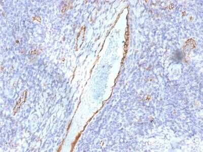 Immunohistochemistry-Paraffin: Von Willebrand Factor Antibody (F8/86) [NBP2-53345] - Formalin-fixed, paraffin-embedded human Tonsil stained with vWF Monoclonal Antibody (F8/86)