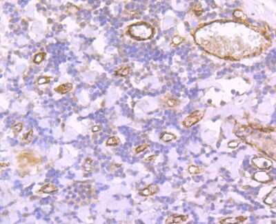 Immunohistochemistry-Paraffin: Von Willebrand Factor Antibody (JJ09-34) [NBP2-67914] - Analysis of paraffin-embedded human tonsil tissue using anti-Von Willebrand Factor antibody. Counter stained with hematoxylin.