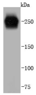 Western Blot: Von Willebrand Factor Antibody (JJ09-34) [NBP2-67914] - Analysis of Von Willebrand Factor on human lung lysates using anti-Von Willebrand Factor antibody at 1/1,000 dilution.