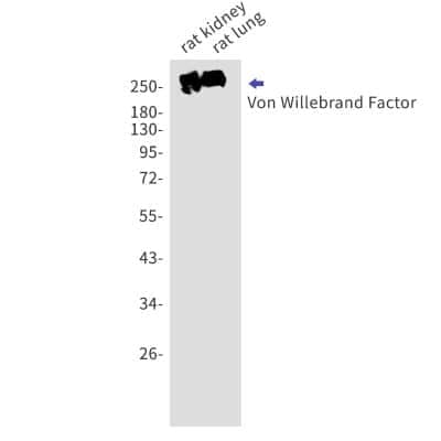 Western Blot: Von Willebrand Factor Antibody (S01-5D2) [NBP3-14887] - Western blot detection of Von Willebrand Factor in rat kidney, rat lung lysates using Von Willebrand Factor antibody. Predicted band size: 309kDa. Observed band size: 309kDa.