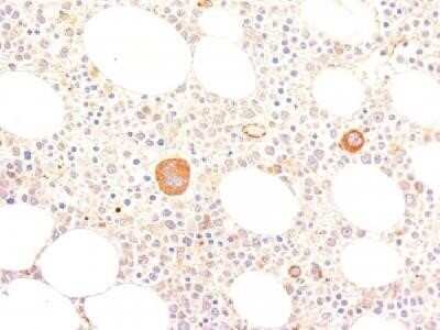 Immunohistochemistry-Paraffin: Von Willebrand Factor Antibody (VWF635) - Azide and BSA Free [NBP2-34510] - Formalin-fixed, paraffin-embedded human bone marrow stained with vWF Monoclonal Antibody (VWF635)
