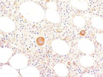 Immunohistochemistry-Paraffin: Von Willebrand Factor Antibody (VWF635) [NBP2-33003] - Formalin-fixed, paraffin-embedded human bone marrow stained with vWF Monoclonal Antibody (VWF635)