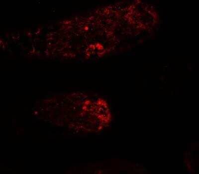 Immunocytochemistry/ Immunofluorescence WAC Antibody - BSA Free