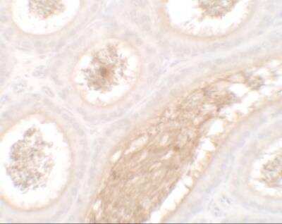 Immunohistochemistry WAC Antibody - BSA Free